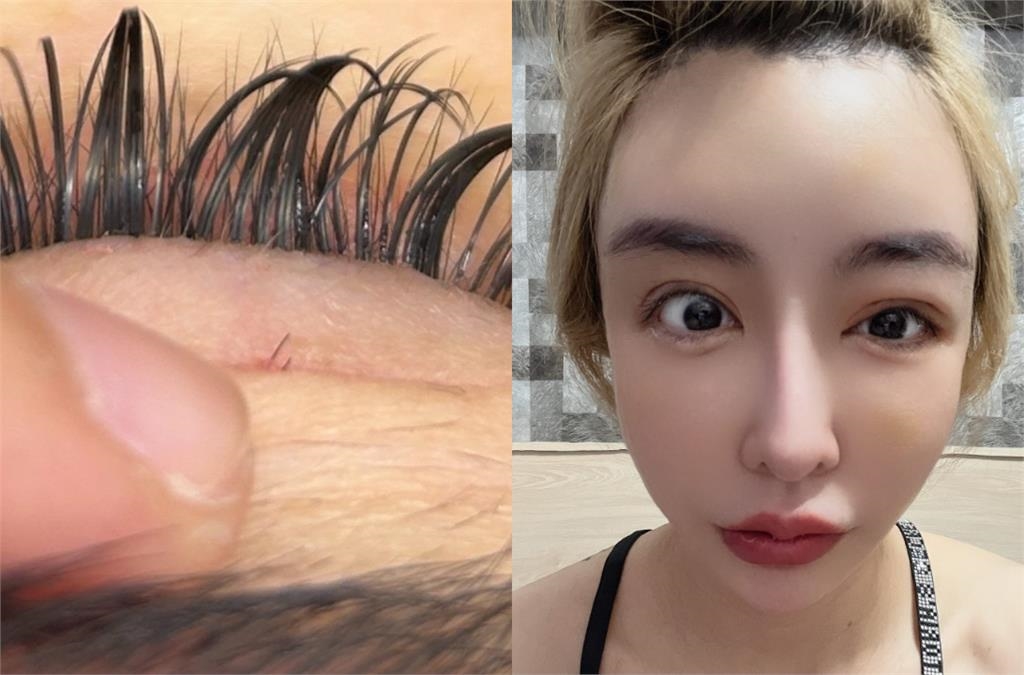 超兇教主「整型失敗」慘況流出!崩潰認了「沒1家診所敢動刀」:回不去了