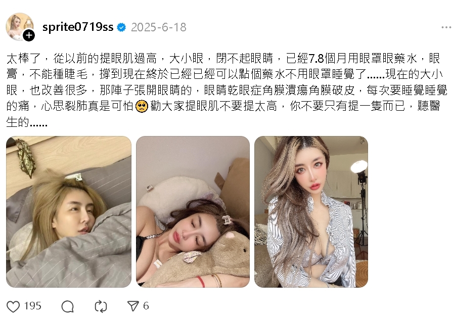 超兇教主「整型失敗」慘況流出!崩潰認了「沒1家診所敢動刀」:回不去了