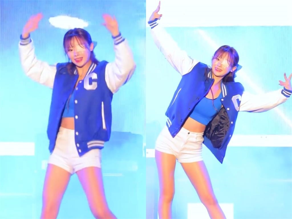 金娜妍1天只睡2小時出事了！眼睛長皮蛇「發高燒+全身痛」嘆：恐永久留疤