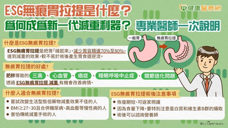 ESG無痕胃拉提是什麼?為何成為新一代減重利器?專業醫師一次說明