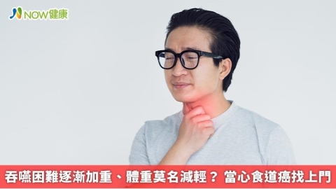 吞嚥困難逐漸加重、體重莫名減輕？ 當心食道癌找上門