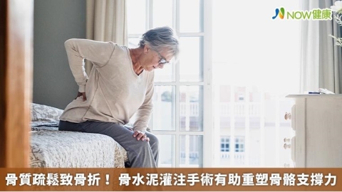 骨質疏鬆致骨折！ 骨水泥灌注手術有助重塑骨骼支撐力 