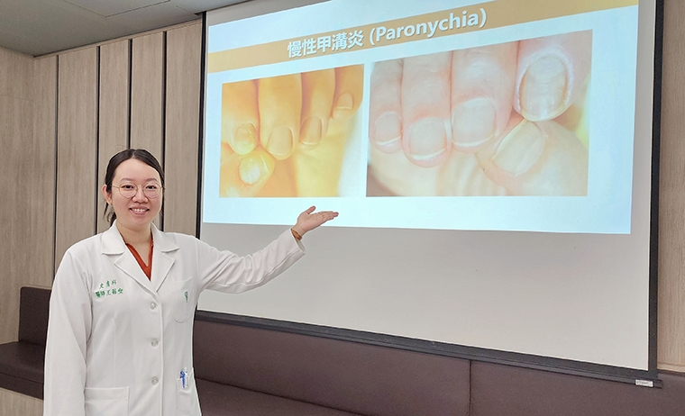 修剪指甲方式錯誤恐引發甲溝炎！ 醫：應從中間開始剪