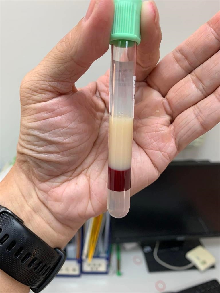 病患抽血「半管全是油」護理師也看傻！超真實1幕嚇壞網：不敢吃雞排了