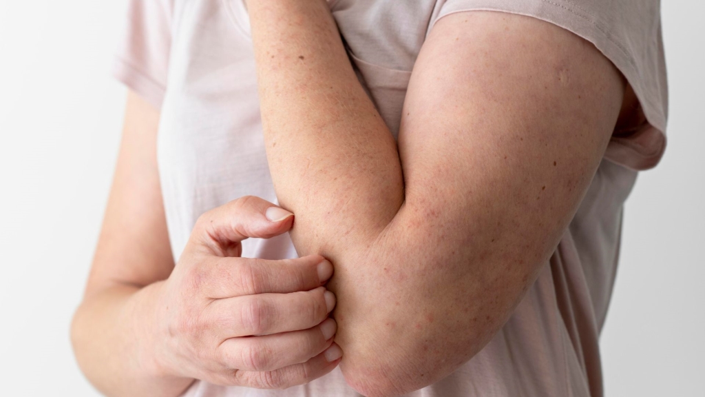 養陰潤燥不怕皮膚乾癢！中醫養生菜單乾癢、濕疹、皮膚炎日常保養秘方