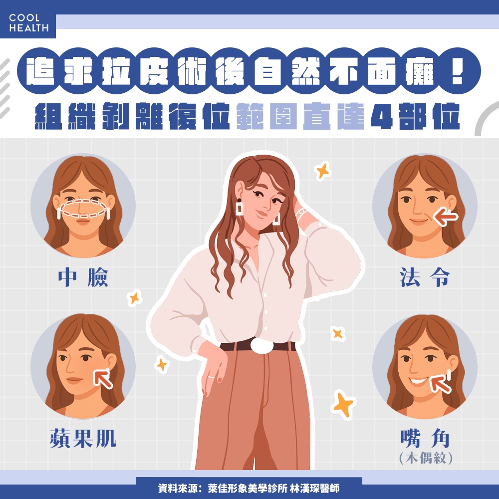 追求拉皮術後自然不「面癱」 關鍵竟然在1儀器