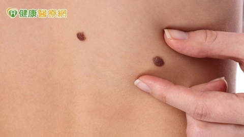 私密處長痣還是病? HPV感染與私密處病變 從痣到癌前病症警訊