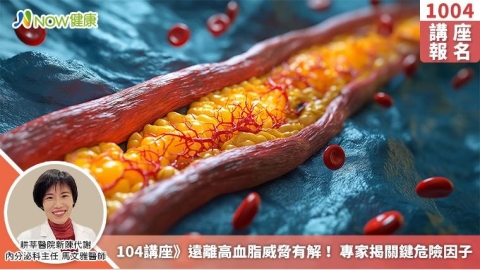 10/4講座》遠離高血脂威脅有解！ 專家揭關鍵危險因子