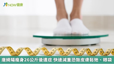 唐綺陽瘦身26公斤後遺症 快速減重恐致皮膚鬆弛、眼袋