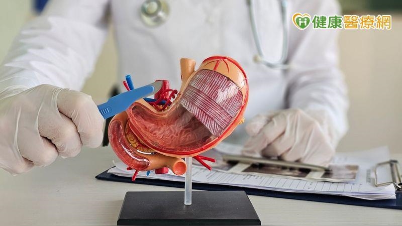 減重手術後出現嚴重貧血併發症　「二次手術修正」找回健康