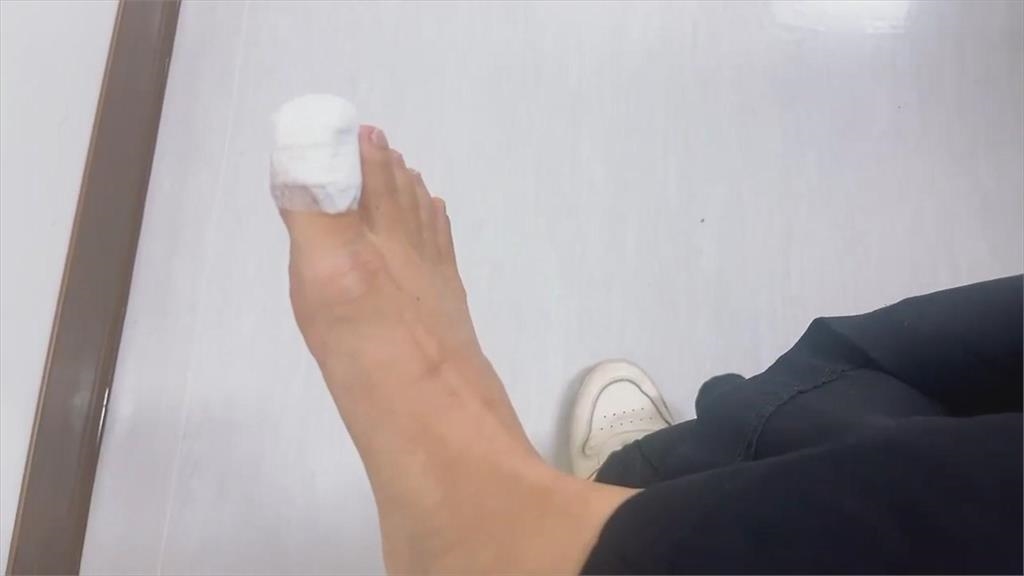 好痛!台南民眾市場買菜被米奇咬傷 市場管理單位回應了