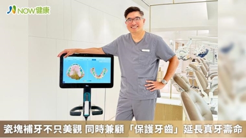 瓷塊補牙不只美觀 同時兼顧「保護牙齒」延長真牙壽命