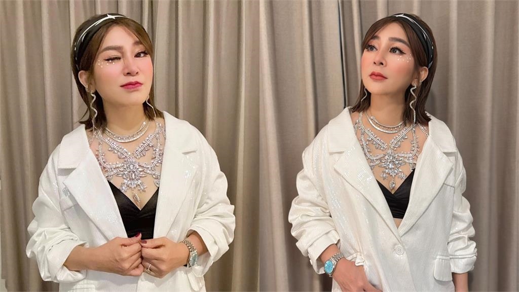 王彩樺曝「醫美後遺症」玻尿酸燒20萬 泛淚喊話酸民「放過我吧、我都57歲了」