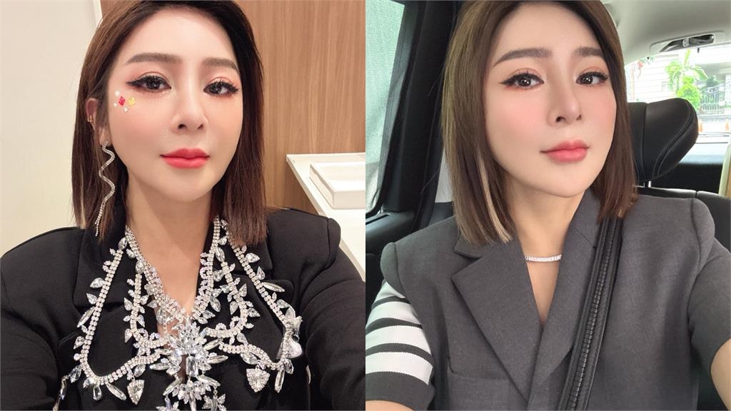 王彩樺曝「醫美後遺症」玻尿酸燒20萬 泛淚喊話酸民「放過我吧、我都57歲了」