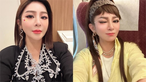 王彩樺曝「醫美後遺症」玻尿酸燒20萬　泛淚喊話酸民「放過我吧、我都57歲了」