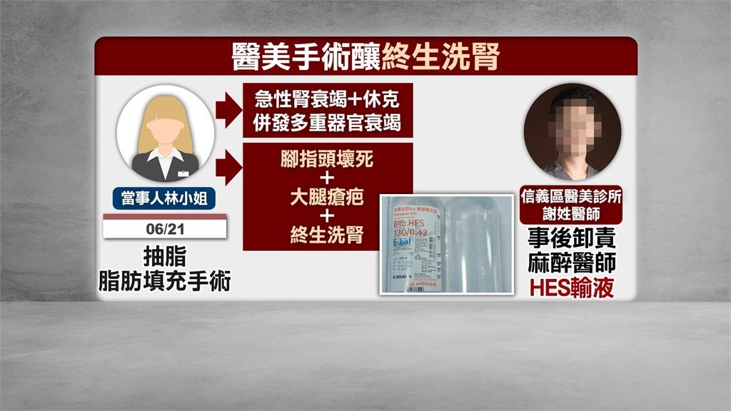 抽脂手術竟「終生洗腎」 陳情人曝醫師欲花200萬私了
