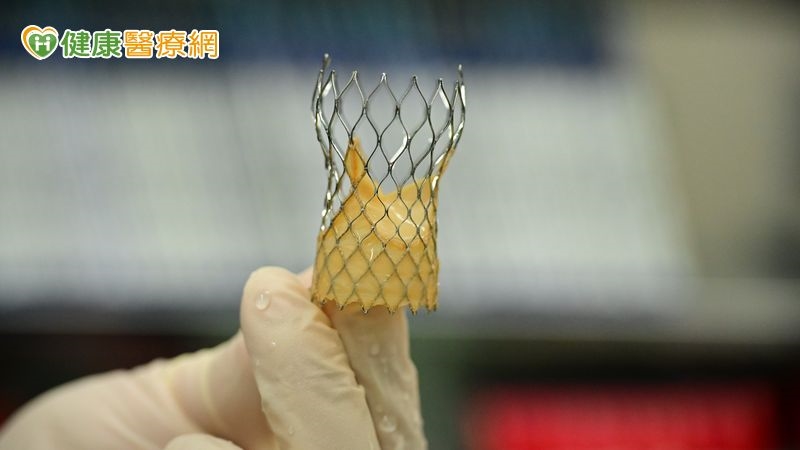 7旬洗腎翁主動脈狹窄復發 植入「瓣中瓣」重獲心生機
