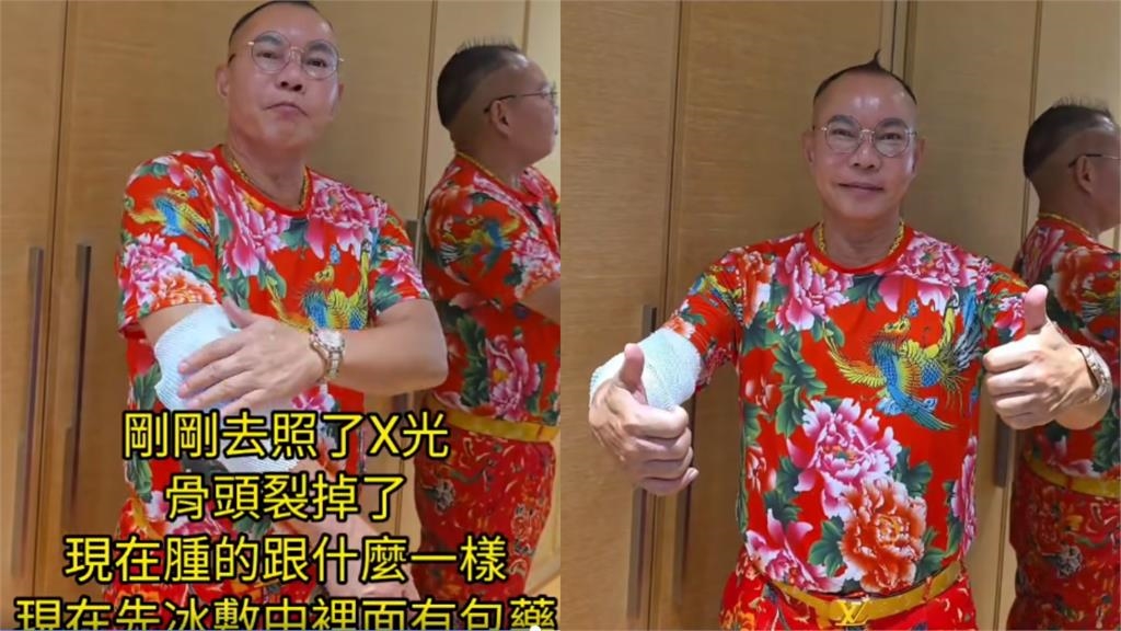 擁4妻14孩「竹北吊車大王」太激情出事了！PO全身傷勢照：不能逞強