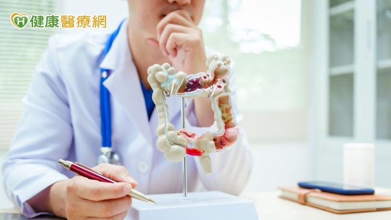 生活規律大腸也會長息肉？家族病史影響大　年輕人也要注意！
