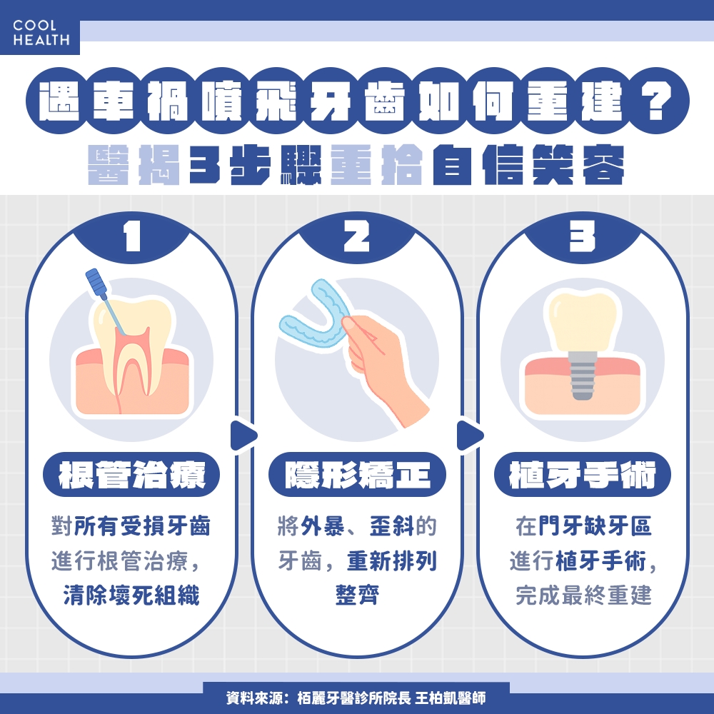 遇車禍噴飛兩顆門牙！ 她用「隱形矯正+植牙手術」重拾笑容