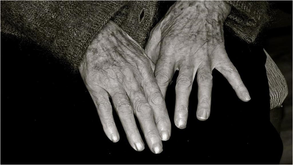 女睡醒「肉身滿是抓痕」講一半斷片！「喝符水、祭改全無用」醫一驗抓出元凶