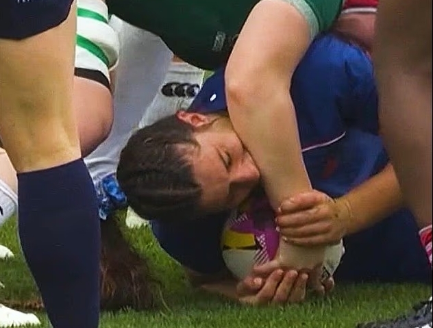 橄欖球(影)／衝撞混戰動手還動口「咬人」！女子橄欖球世界盃法國贏球引爆爭議