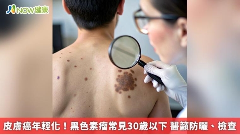 皮膚癌年輕化！黑色素瘤常見30歲以下 醫籲防曬、檢查