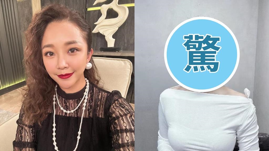 賴慧如才暫別八點檔！無預警宣布幹大事「親自往頭動刀」瞬間回春重返18歲