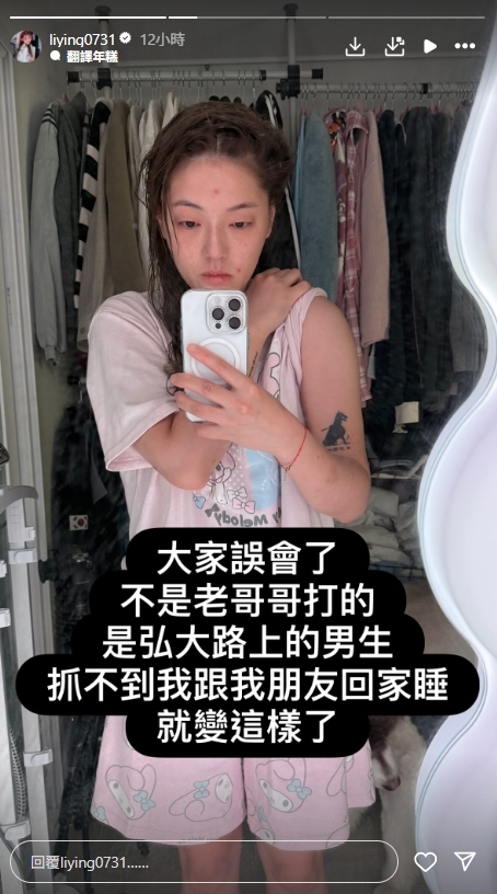 台灣46萬YTR「拒絕陪睡」遭韓國人當街暴打!全身瘀青、骨折傷勢照曝光