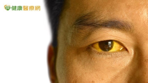 75歲退休教授突全身發黃！　竟是B肝急性肝衰竭險喪命