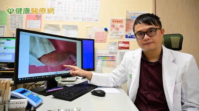 新生女嬰全身長滿小水泡紅疹　竟是罕病「色素失調症」