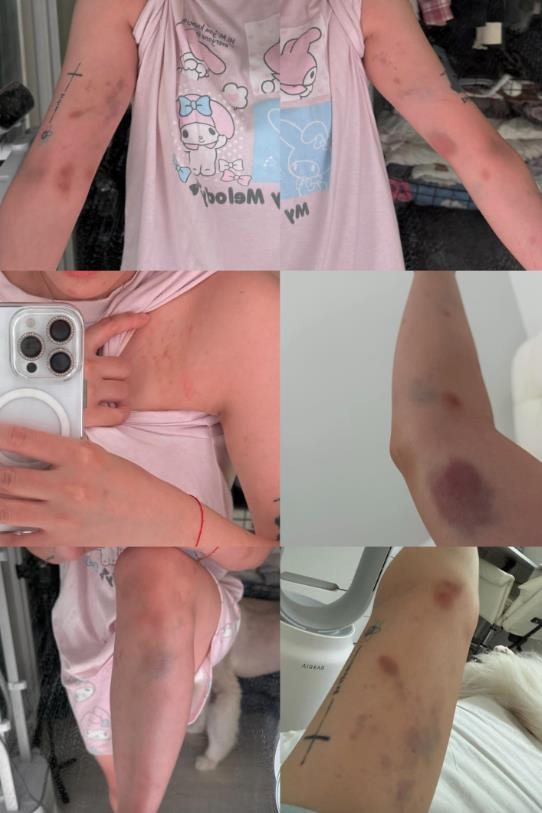 噴韓男太小「台正妹拒陪睡被揍」露臉了!路人聽1句「沒報案」警到場:很常見