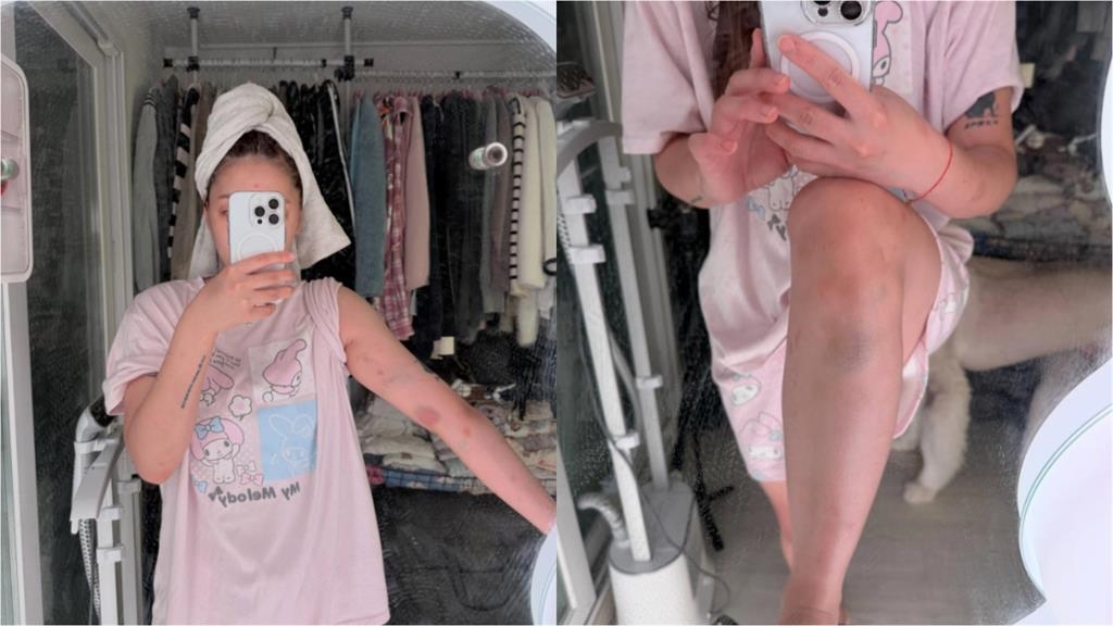 噴韓男太小「台正妹拒陪睡被揍」露臉了!路人聽1句「沒報案」警到場:很常見