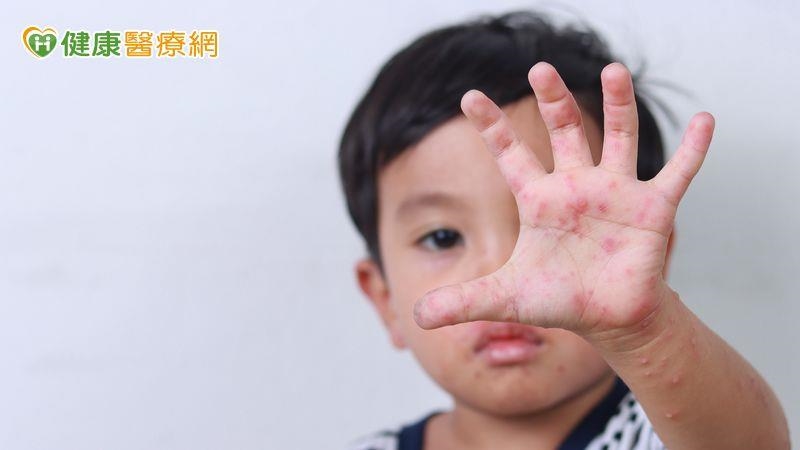 腸病毒重症已奪8命！伊科11型來勢洶洶　疾管署：幼童是高風險族群