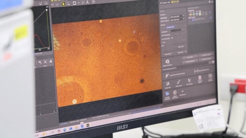 失智?8旬退休老師突無法自理生活 竟是隱球菌腦膜炎作祟