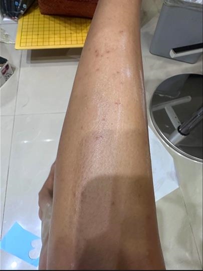 日月潭雲品爆「日客被床蝨叮咬」　客轟態度消極求償逾170萬