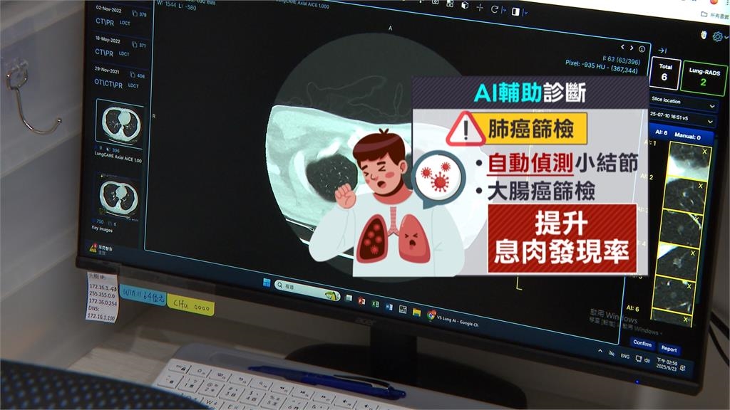 政府加碼降低癌篩年齡　醫院診所健檢服務每年11%成長