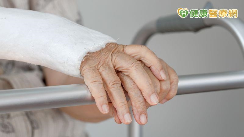 老翁打石膏抓破皮險釀重症！新型科技石膏輕量、透氣、固定佳突破困境