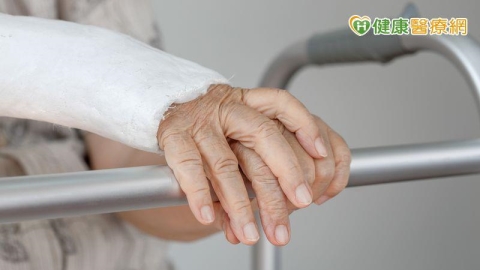 老翁打石膏抓破皮險釀重症!新型科技石膏輕量、透氣、固定佳突破困境