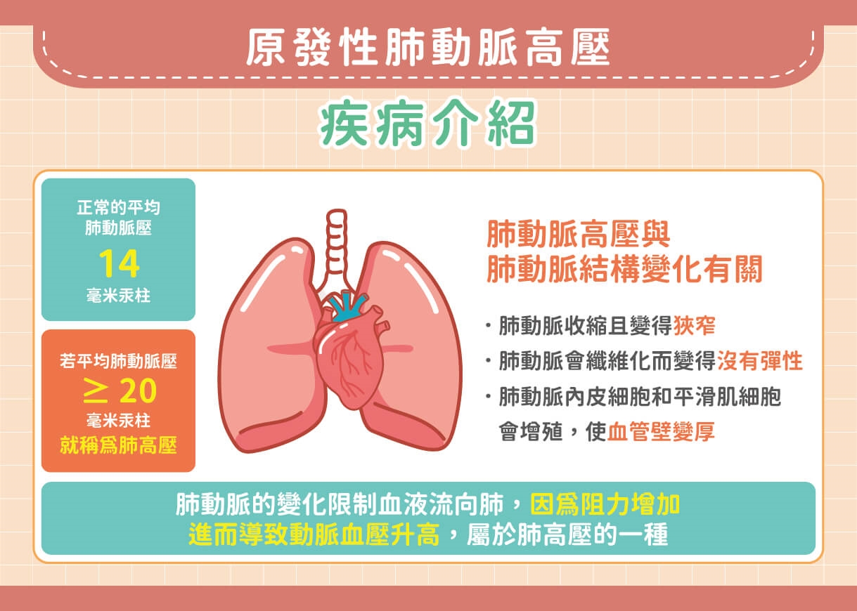 比癌更致命！「原發性肺動脈高壓」新藥現曙光助病友延命
