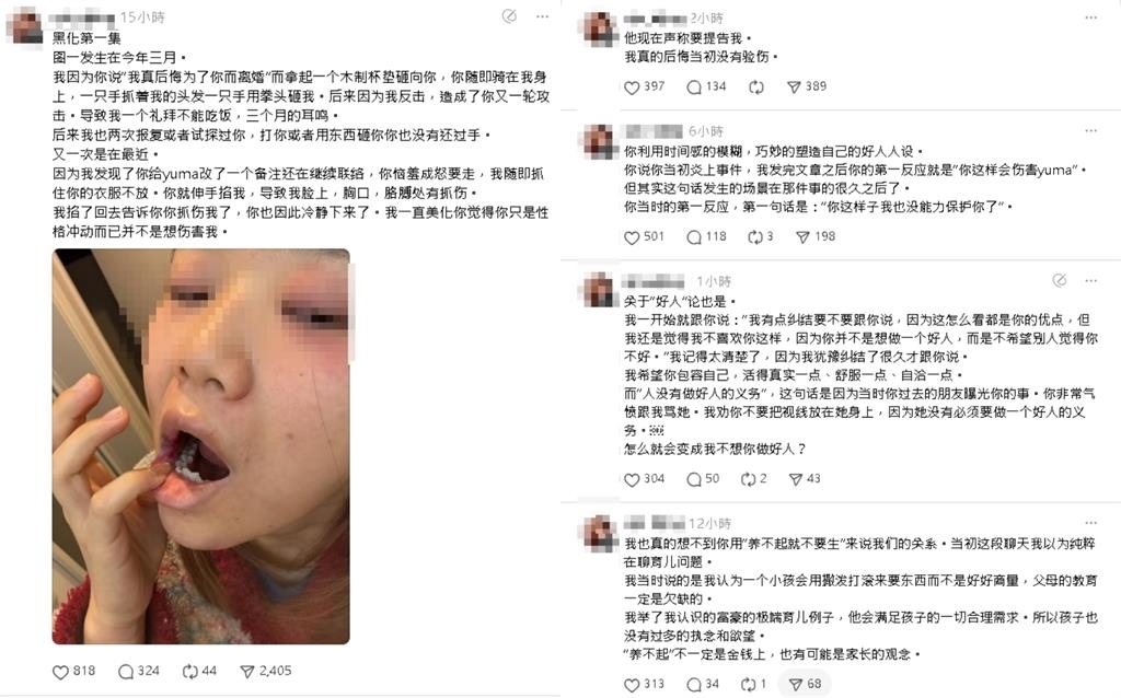 小三畫家控遭Ryu「毆打、掐脖」傷痕照曝光！他不忍反嗆：酒瓶砸我脖子上