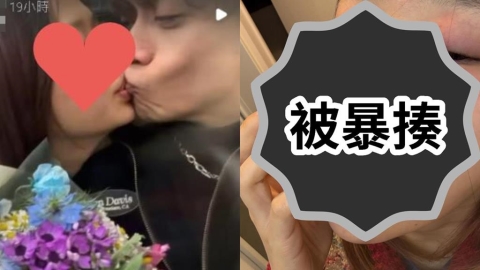 小三畫家控遭Ryu「毆打、掐脖」傷痕照曝光!他不忍反嗆:酒瓶砸我脖子上