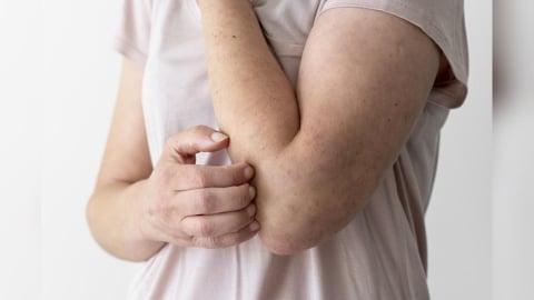 乾癢？紅腫？掉屑屑？皮膚換季保養3關鍵！「這步驟」全年不能省略！