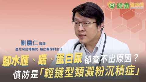 腳水腫、喘、蛋白尿卻查不出原因?慎防是「輕鏈型類澱粉沉積症」