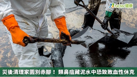 災後清理家園別赤腳！ 類鼻疽藏泥水中恐致敗血性休克