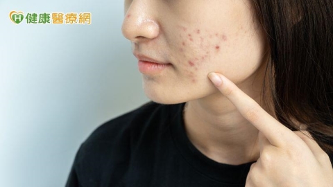 季節交替長痘怎麼辦？中醫：保養肌膚靠這三大關鍵步驟！