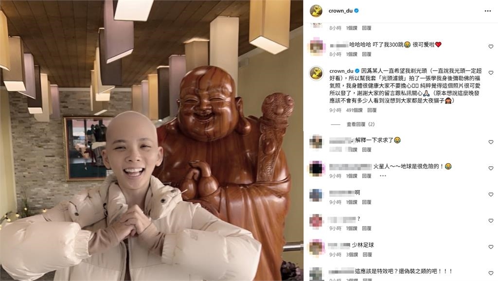 滴妹長髮消失「頂著大光頭」憔悴真面目曝光！萬人嚇爛急問「怎麼了」本人說了