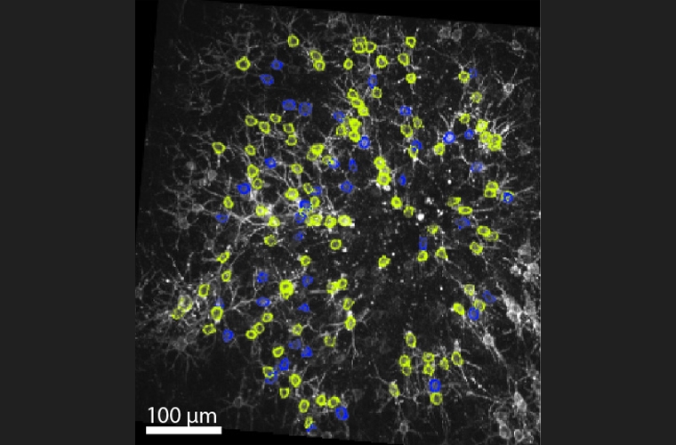 揭開大腦運作之謎! 陽明交大發表神經元放電定位成像