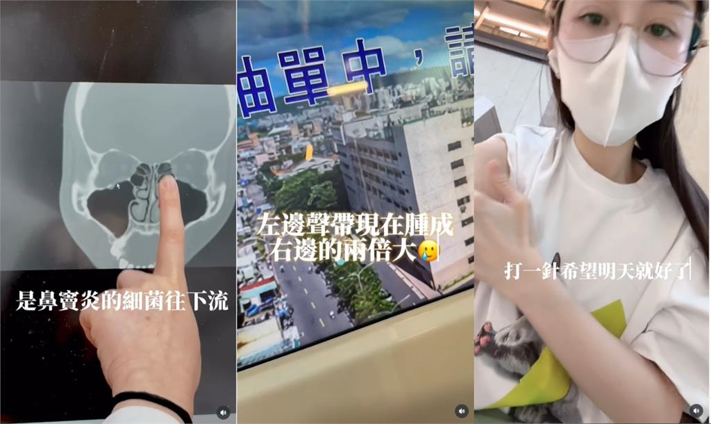 Albee「猛灌超鹹鹽水」出大事！全場竟歪樓「緊盯炸裂1幕」：生病還有福利…