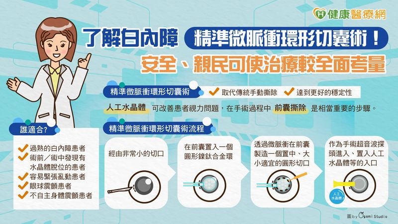 了解白內障「精準微脈衝環形切囊術」！　安全、親民可使治療較全面考量